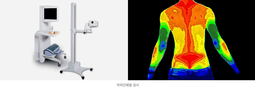 적외선 체열검사